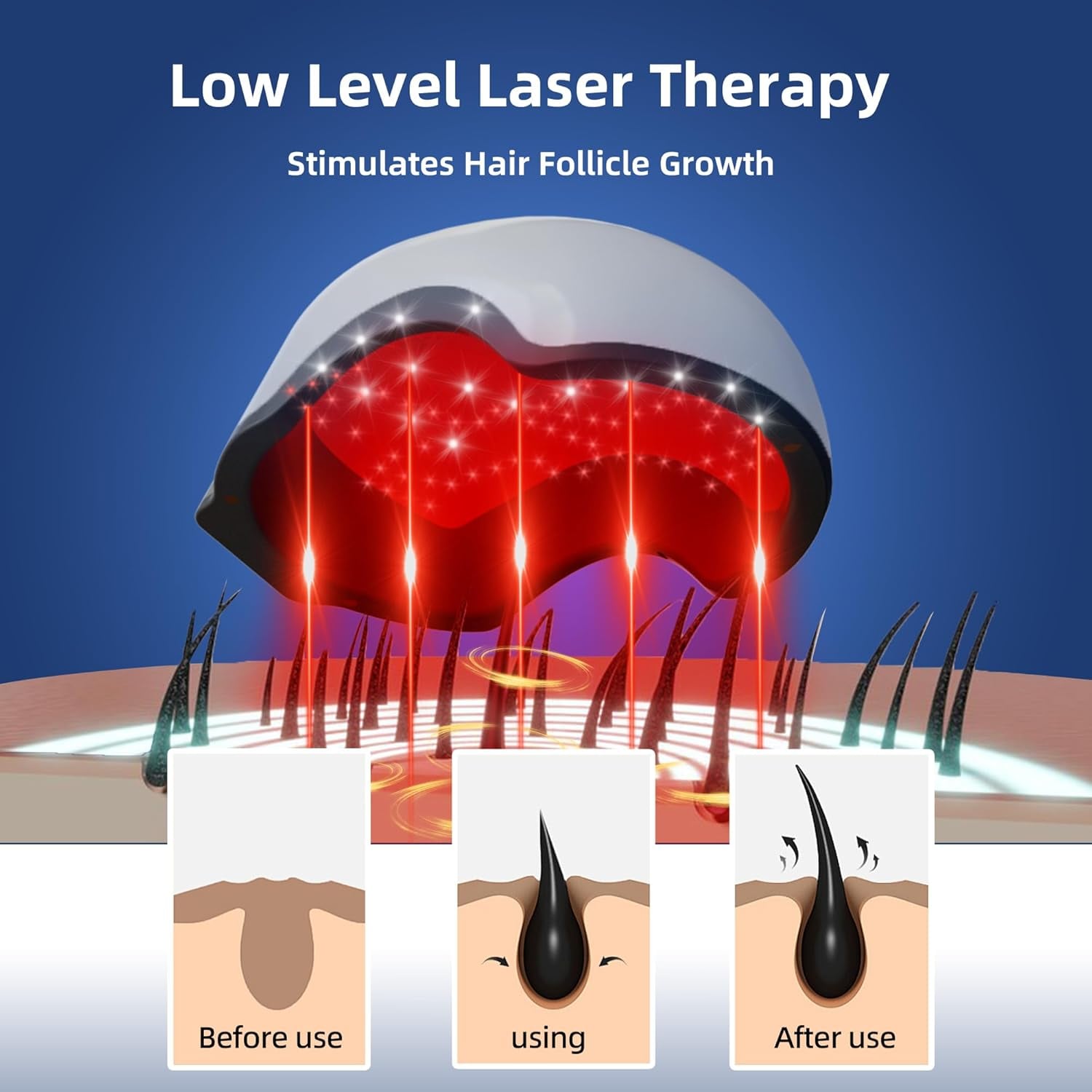 Mediwares Laser Hair Growth Helmet/Cap – 272 LED Red Light Therapy