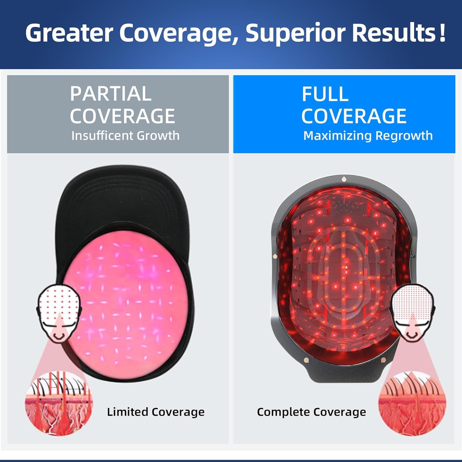 Mediwares Laser Hair Growth Helmet/Cap – 272 LED Red Light Therapy
